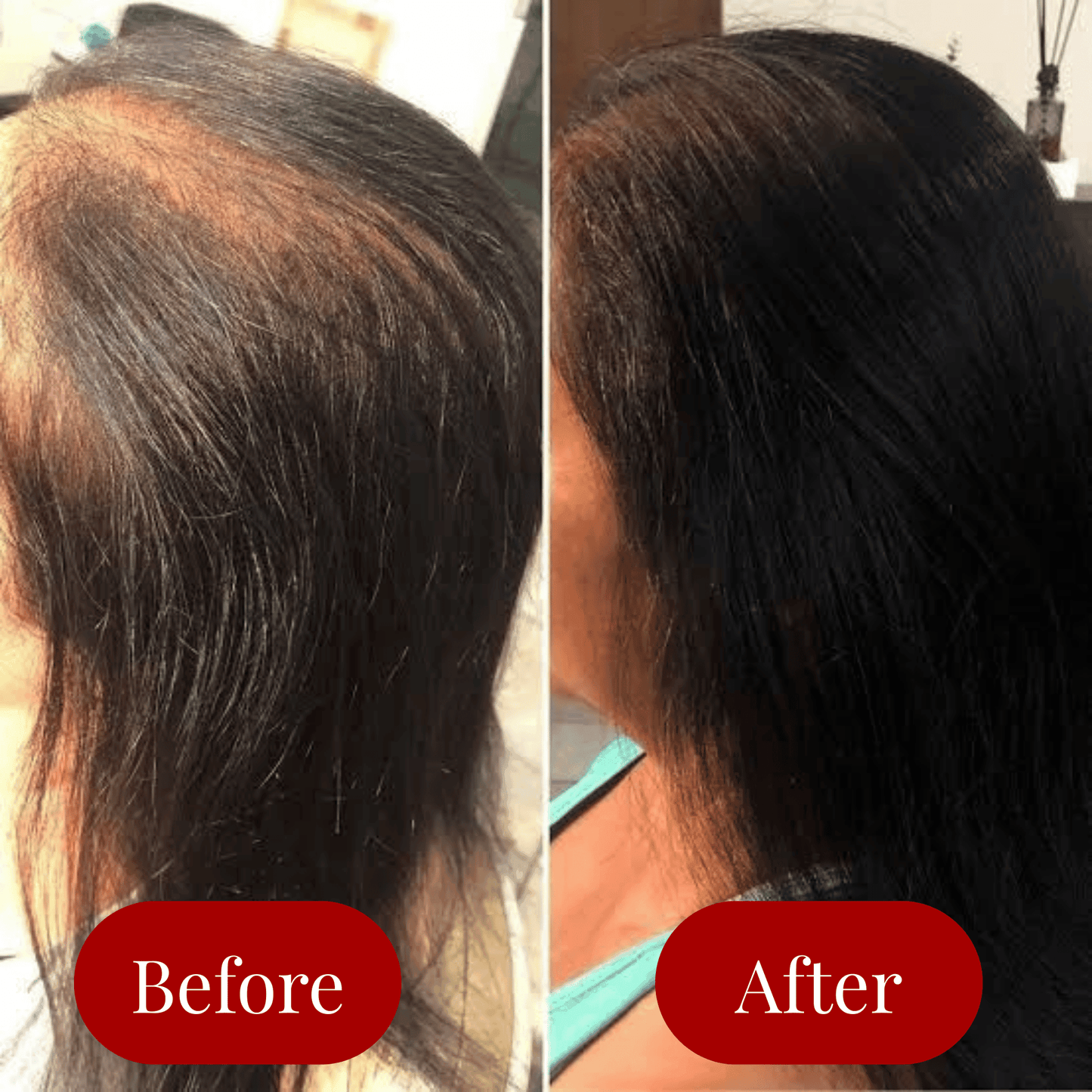 Electric Scalp Massage Comb Aglowra