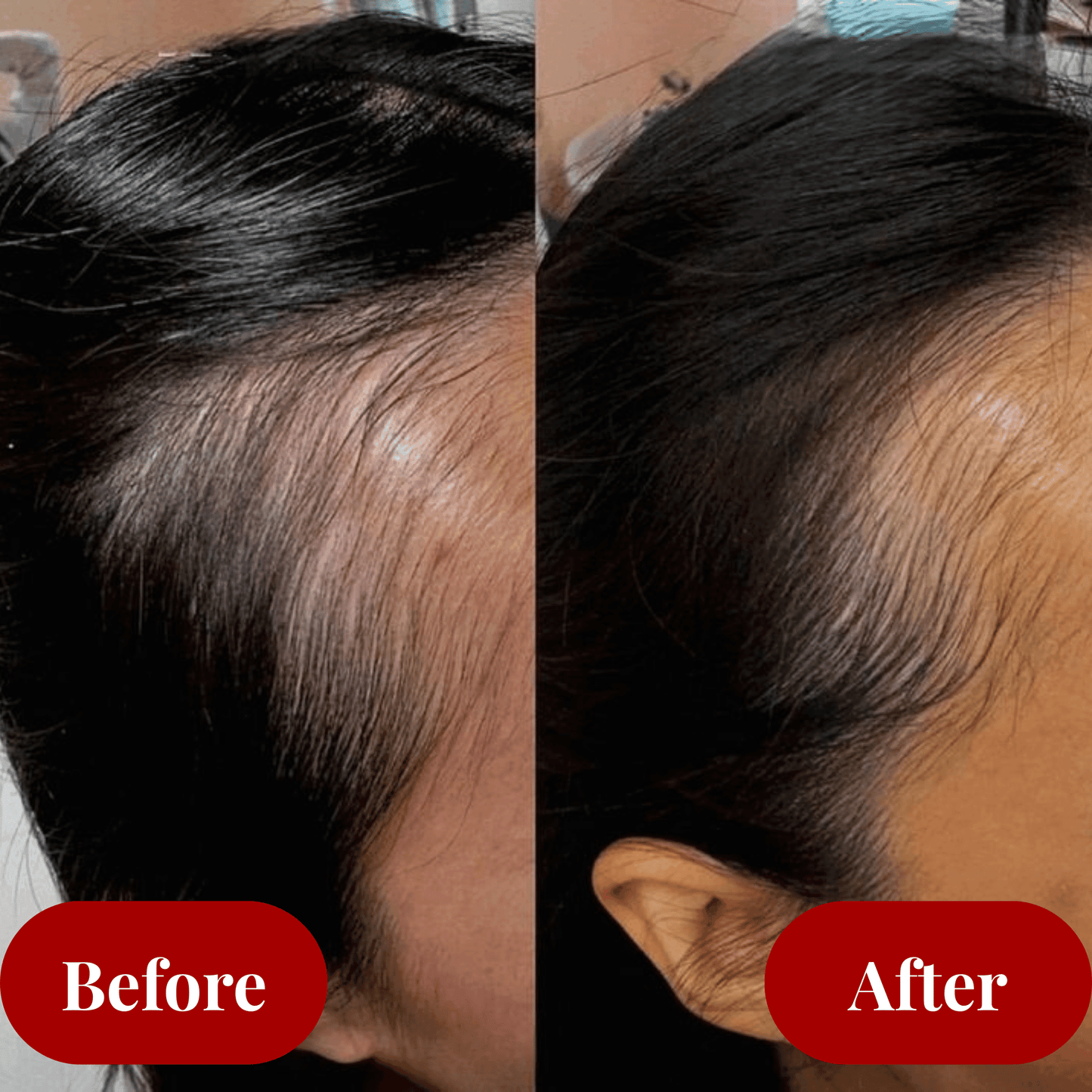 Electric Scalp Massage Comb Aglowra