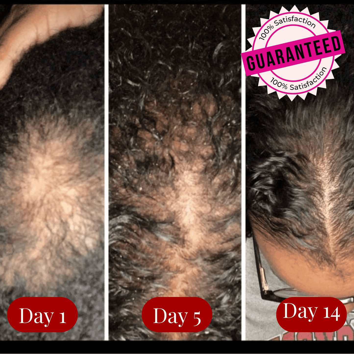 Electric Scalp Massage Comb Aglowra
