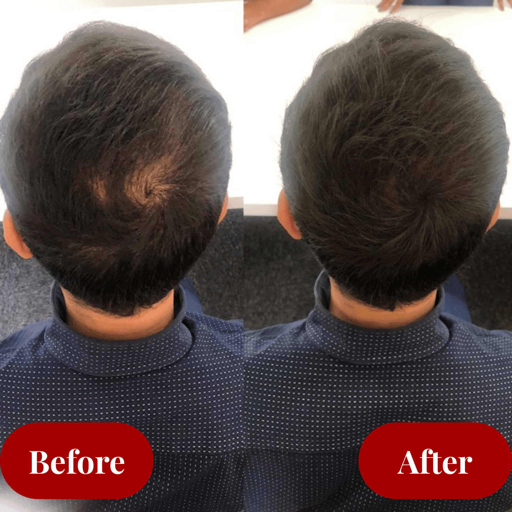 Before and after comparison of a person's hair after using organic hair growth oil