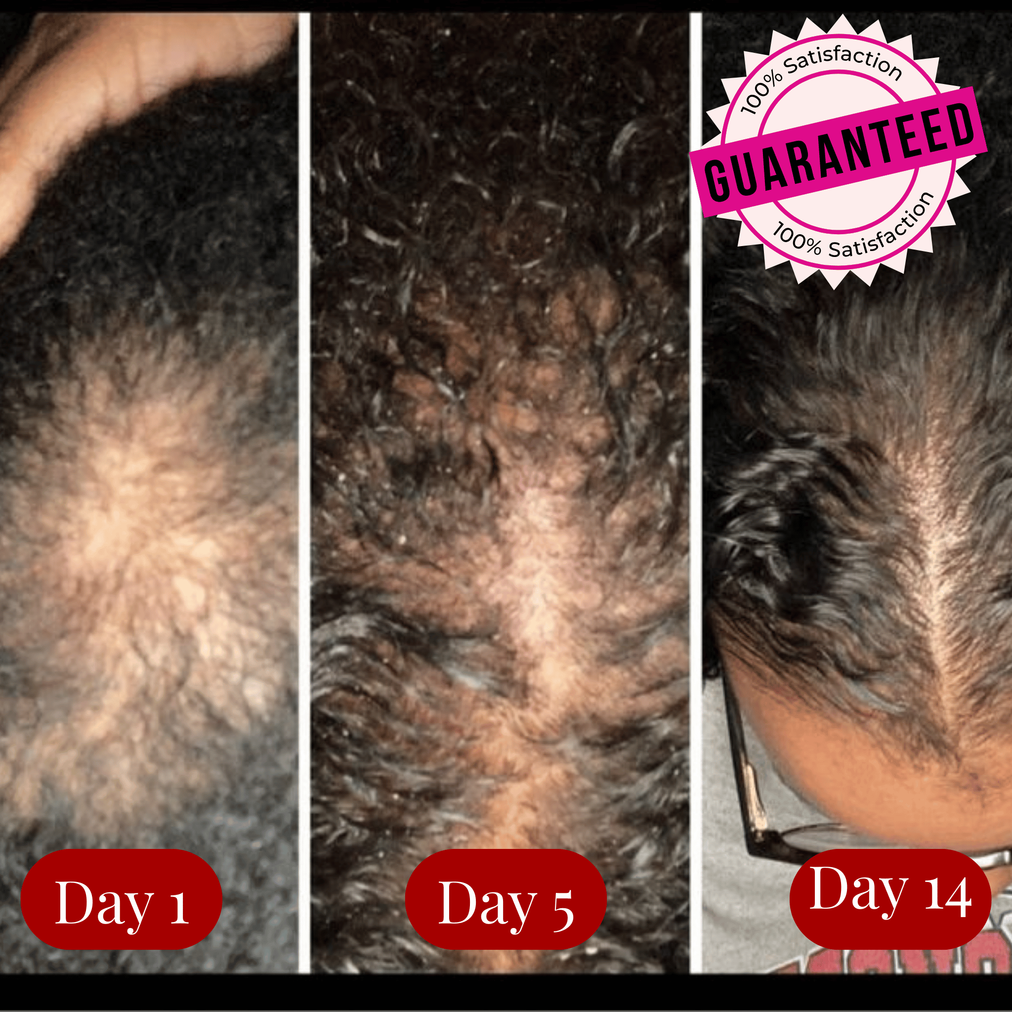 Before and after hair growth comparison over 14 days with a 'Guaranteed' badge.
