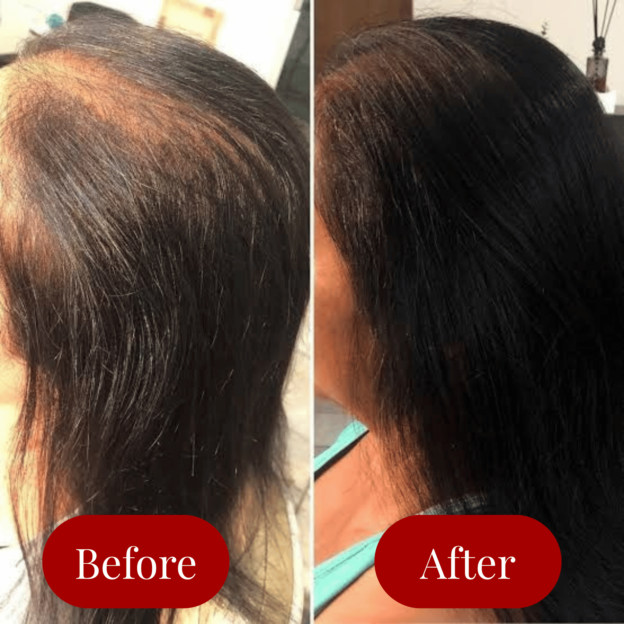 Aglowra™ Organic Hair Growth Oil – Castor + Green Coffee + Rosemary Extract - Aglowra